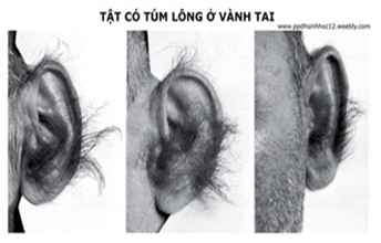 Tật có túm lông ở tai