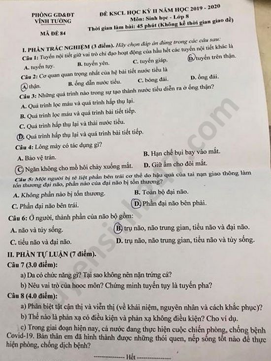 Cận thị là gì sinh 8: Nguyên nhân và cách phòng tránh